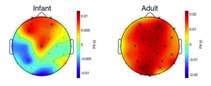 Speech-tracking brain activity.