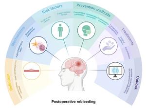 Fig. 1. General overview of postoperative rebleeding.