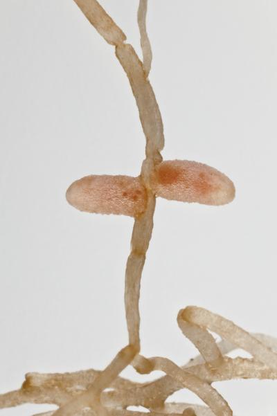 Root Nodules