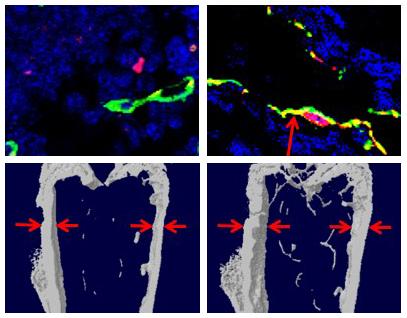 The Drug L-235 Improves Osteoporosis in Mice
