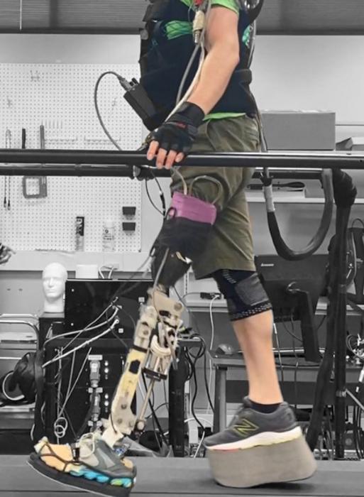 Testing Modified Prosthetics Designed to Help Address Hip, Back Problems in Amputees