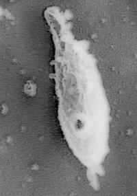 Mycoplasma Pneumoniae