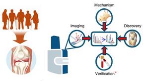 Spatial molecular mapping reveals early bone signatures of osteoarthritis (OA)