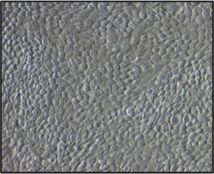 Human Retinal Pigment Epithelial Cell Morphology