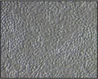 Human Retinal Pigment Epithelial Cell Morphology