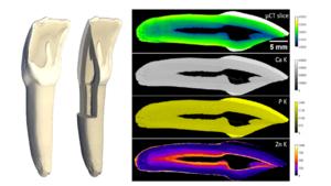 tooth