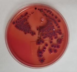 Lab culture of Shigella