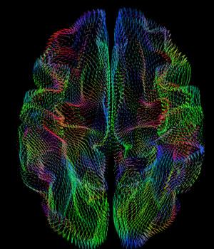 Cerebral Cortex