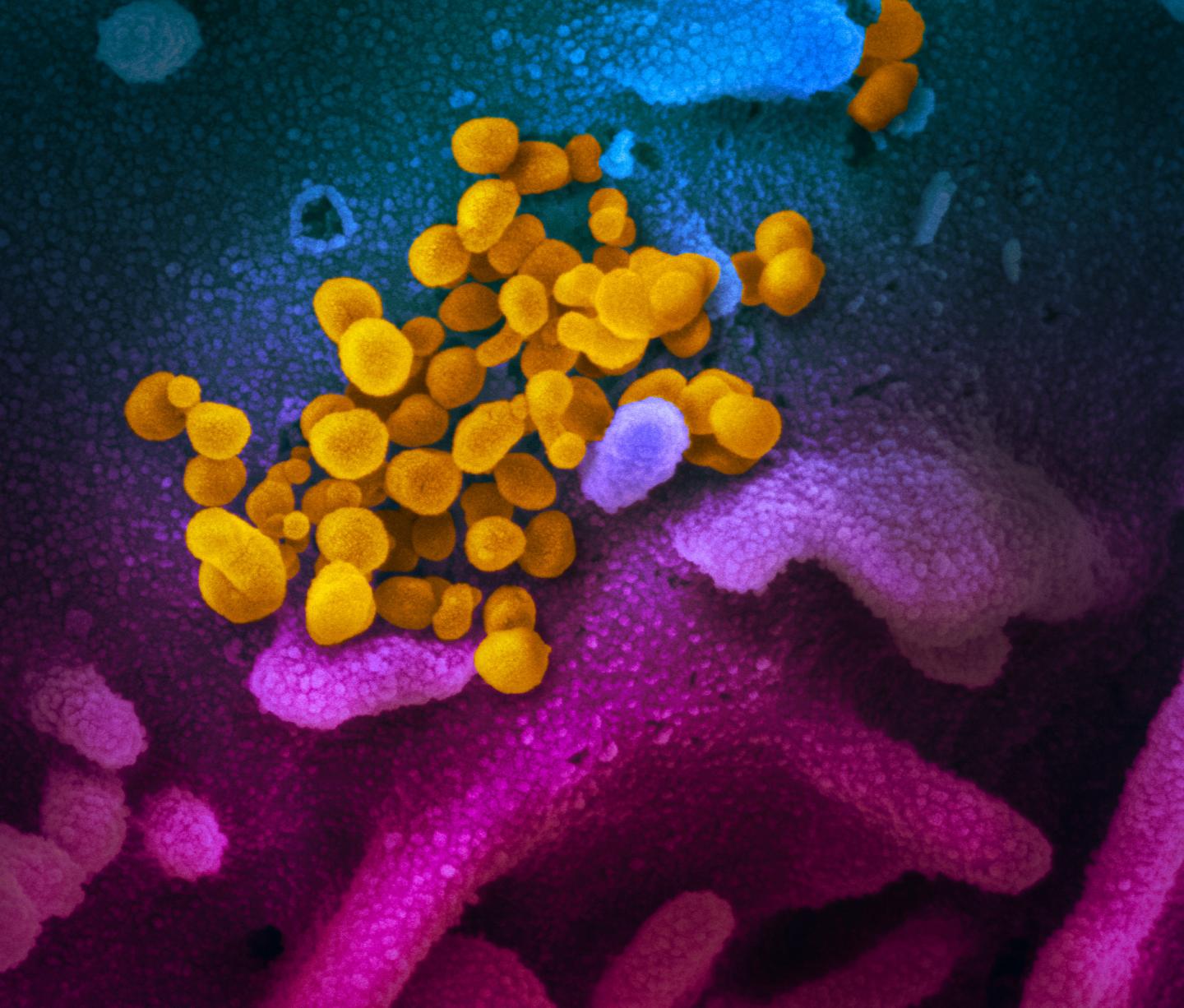 SARS-CoV-2, also known as 2019-nCoV, the virus that causes COVID-19