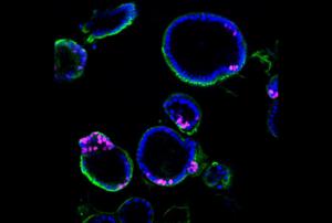 The image shows how CASP5c expression in human colonic organoids increases multiplication of intestinal epithelial cells shown in pink, indicating de novo DNA synthesis. Epithelial cells are labeled green,​​ and nuclei are labeled blue