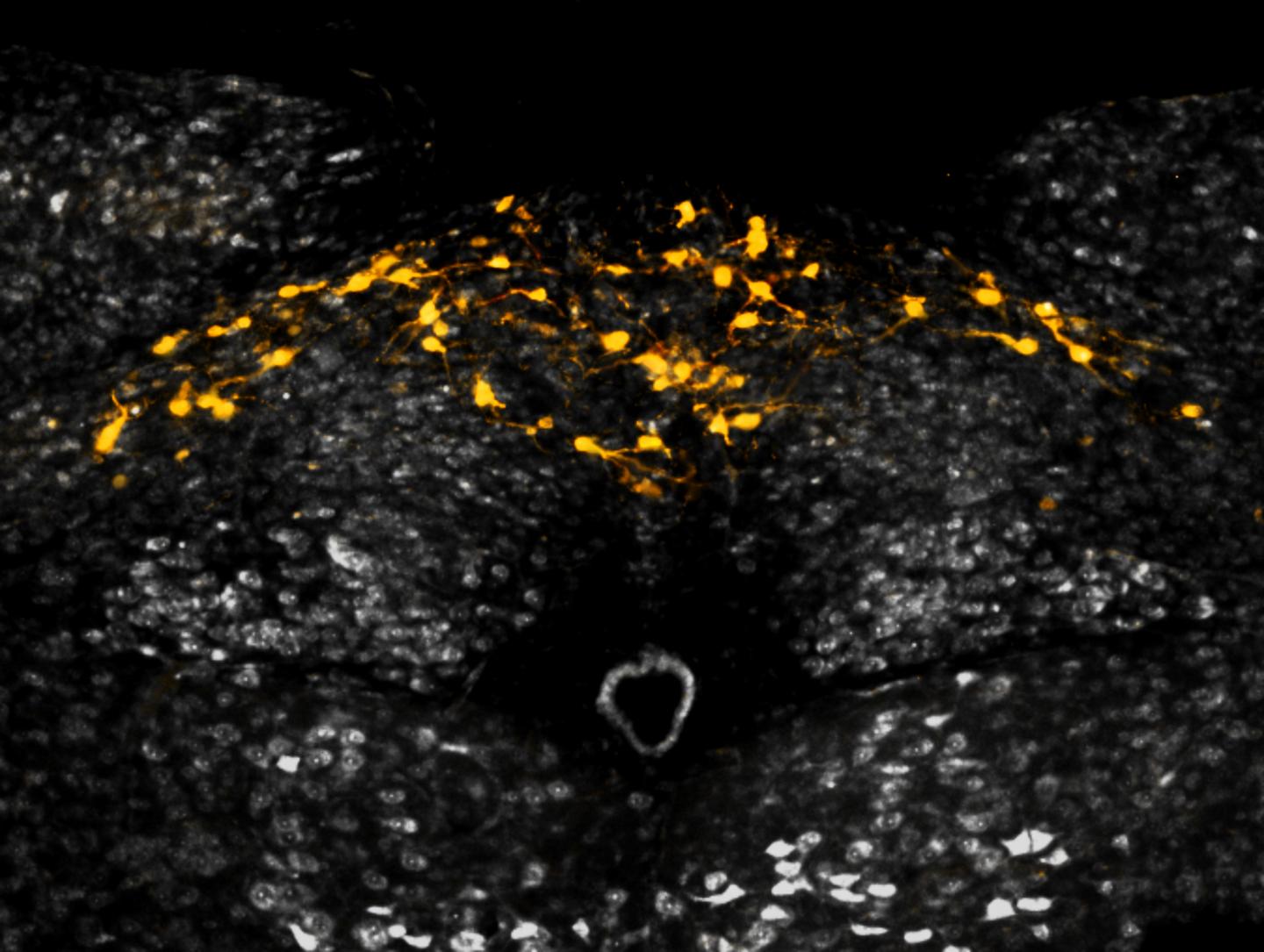 GFRAL-Expressing Neurons