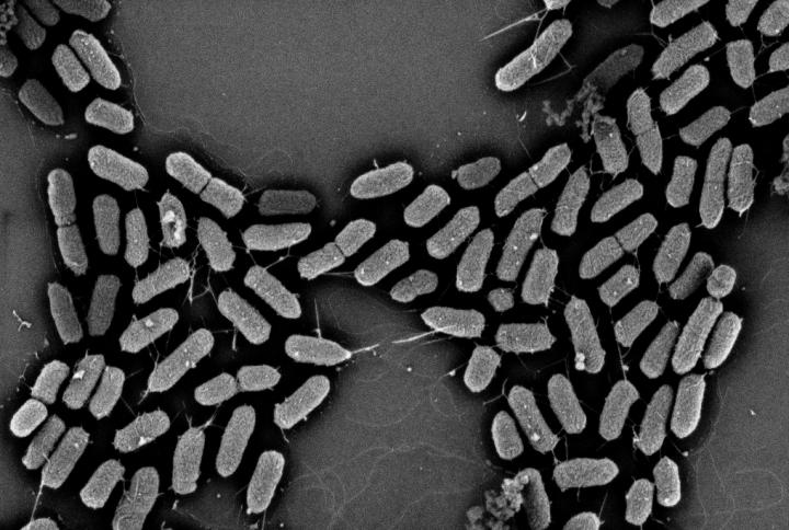 <em>E. coli</em>