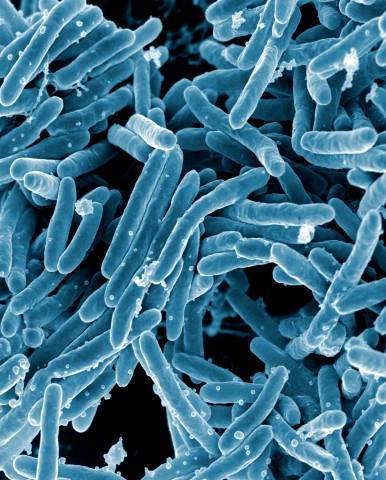 <i>Mycobacterium tuberculosis</i>