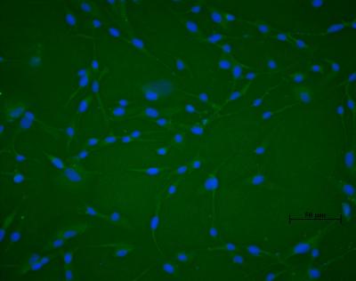 Neurons developed from Human Endometrial  Stem Cells
