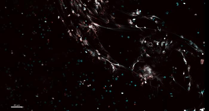 Web-like structures produced by neutrophils