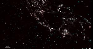 Immune system is already active before birth | EurekAlert!
