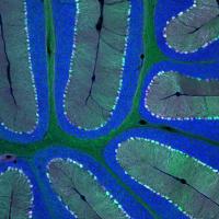 Delivering Genes Across the Blood-Brain Barrier (2 of 2)