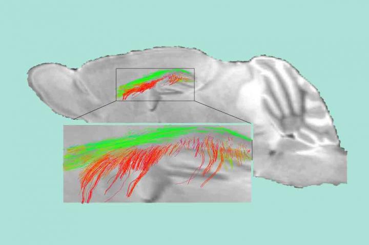 White Matter Disease