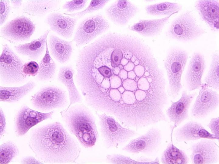 HPV cells