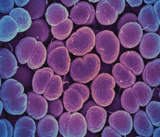 Colorized Scanning Electron Micrograph of Bacteria that Cause Gonorrhea.