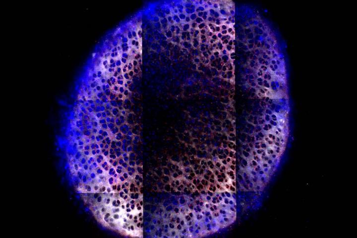 Cartilage Drug Delivery