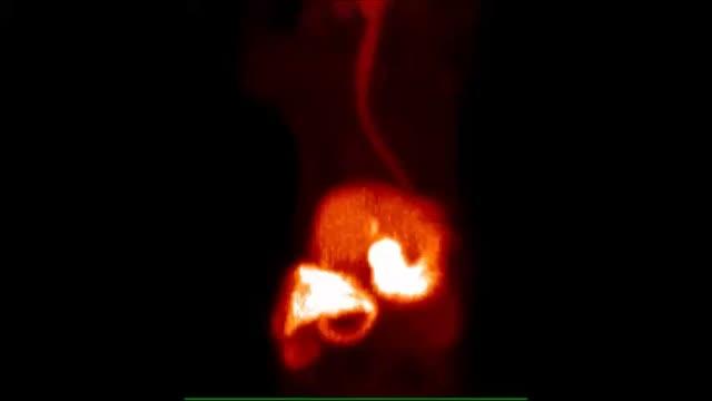 New MS Imaging Technique Video
