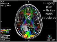 MRI Images