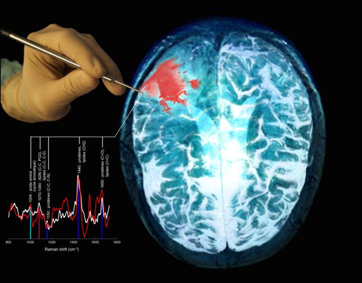 Probe Being Used to Interrogate Brain Tissue during Surgery