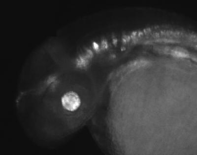 Newly Identified Enhancer Activity in Zebrafish Brain