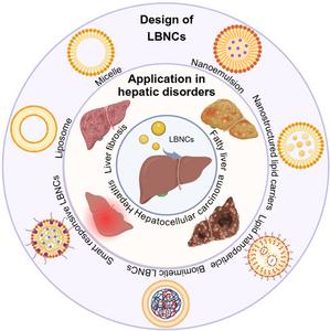Rational Design and Application of Lipid‐Based Nanocarriers in Hepatic Disorders