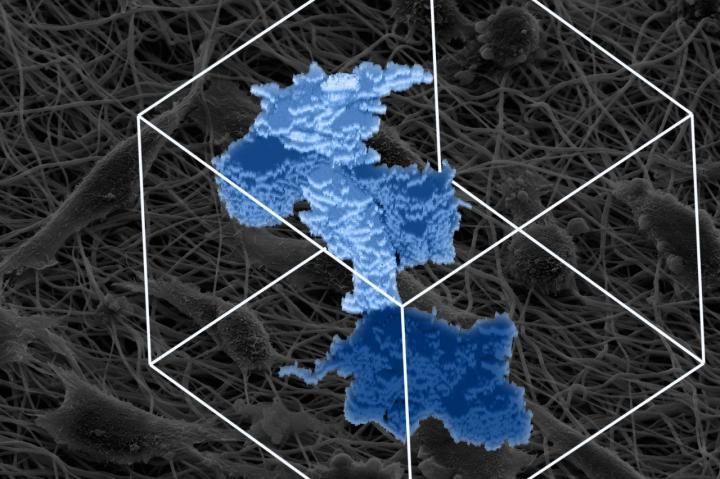 Fibroblasts