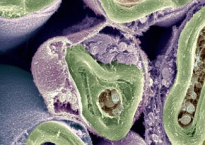 Schwann Cells
