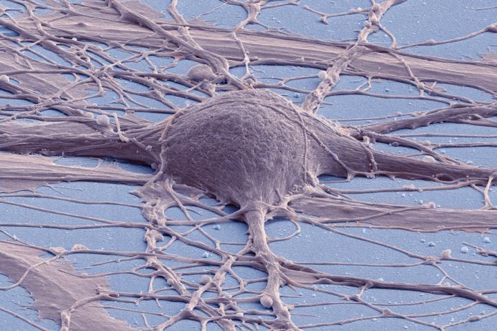 Human-Derived iPSC Neuron
