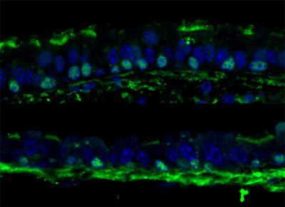Transient TOR activation During Regeneration Leads to Stem Cell Loss