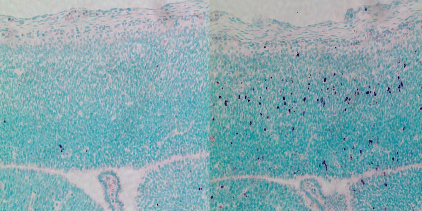 Cell Death