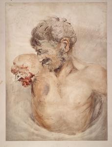 Waterloo soldier missing right arm