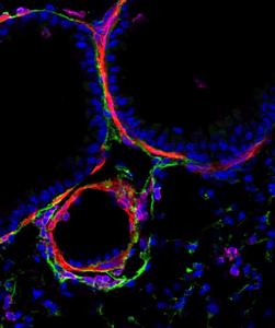 Stromal cells (in green), which possess memory properties, around the bronchiole (smooth musculature, in red), and specifically recruited immune cells (in pink).