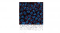 LEPI Cells