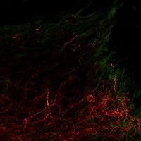 Axons at the Spinal Cord Injury Site