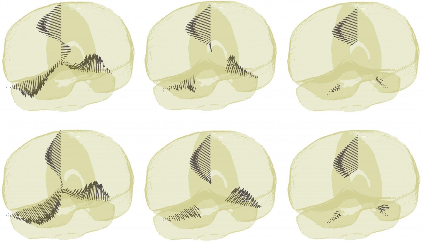 Shearing Effect