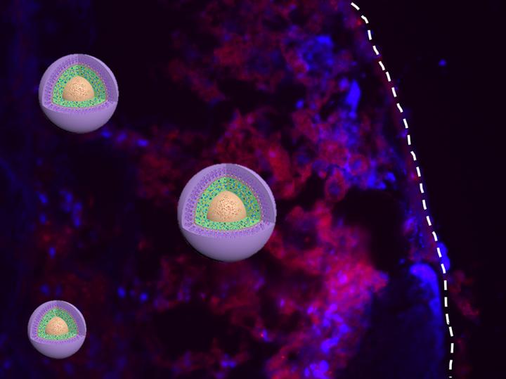 Nano Medicine