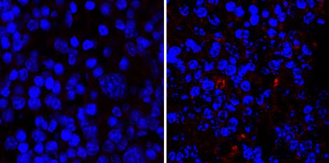 Intestinal Bacteria Migrate to the Spleen
