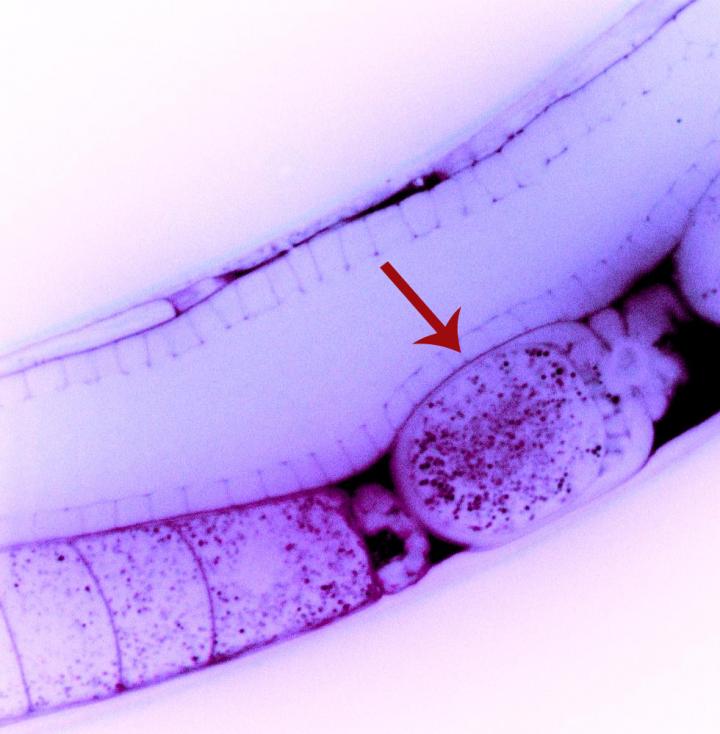 <em>C. elegans </em>Egg Cell with dsRNA Particles