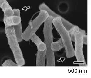 Pole shapes of E. coli