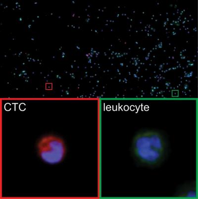 CTC Image Labels