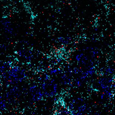 Astrocytes