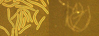 Overexpression of CapD Results in a Smaller Capsule in <i>Bacillus anthracis</i>