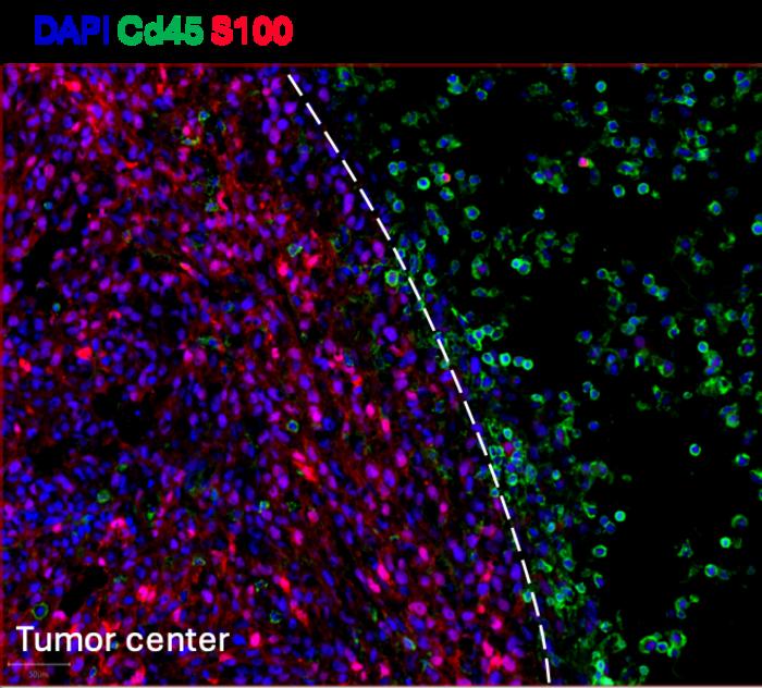 CD45 immune cells (green) are unable to penetrate the tumor bed (red).