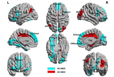 Brain Regions