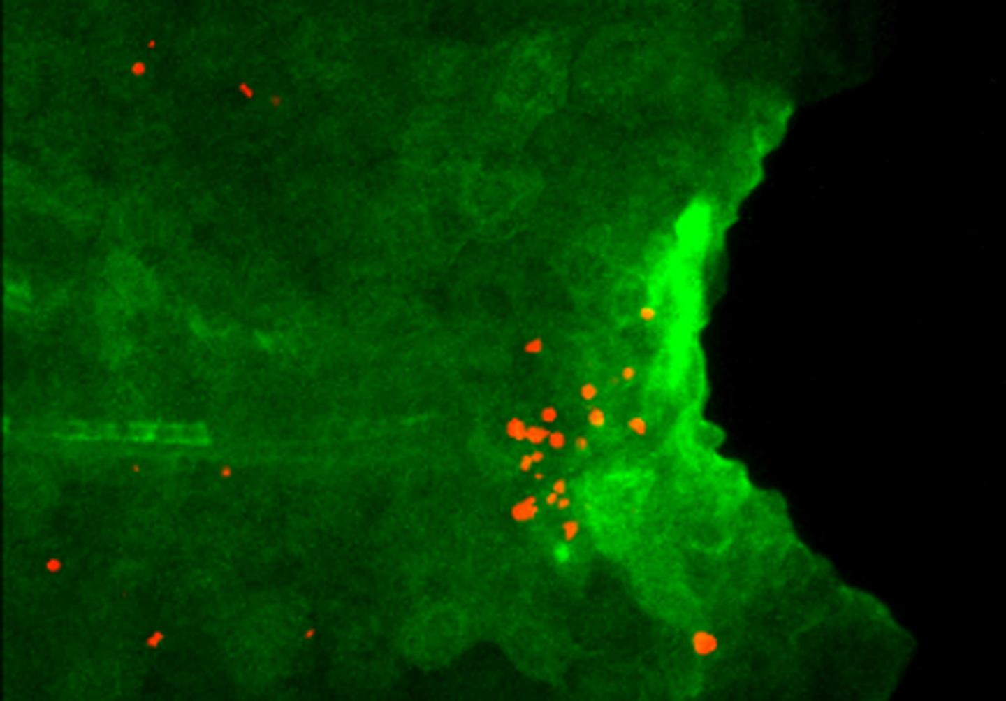 Excess Il1b Induces Apoptosis of Regenerative Cells